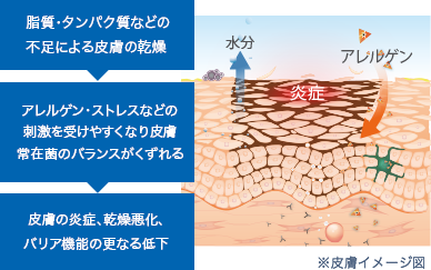 乾燥肌・敏感肌のバリア機能低下メカニズム 皮膚構造イメージ図(ビオデルマ アトデルム)