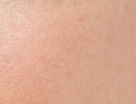 お肌について 水分不足による乾燥肌 ビオデルマ公式サイト